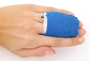 Injured fingers that are wrapped in a finger cast.